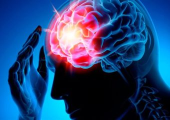 29 жовтня у світі відзначають Всесвітній день боротьби з інсультом